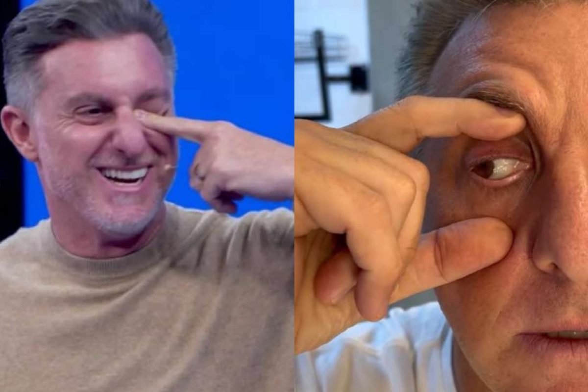 Luciano Huck teve o olho atingido no Domingão (Reprodução/TV Globo) Foto: Contigo