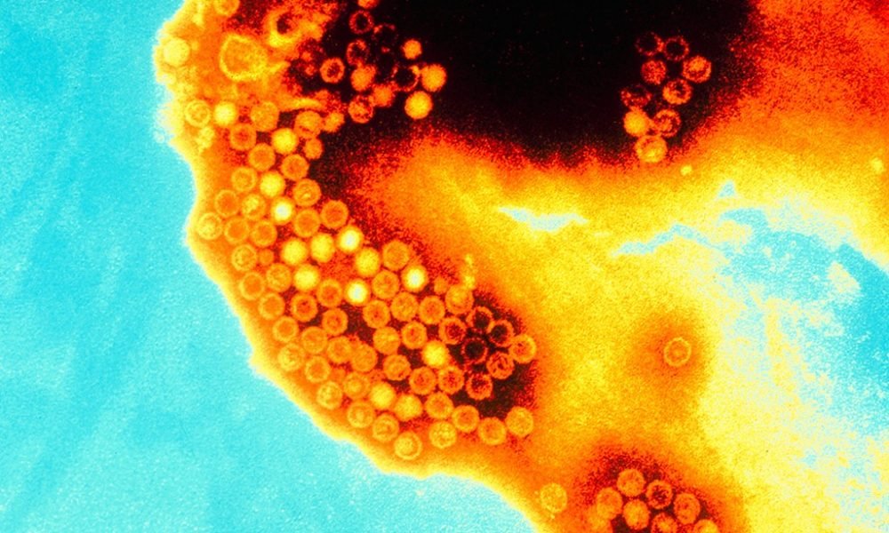 ém não é um surto com crescimento exponencial, mas é um número além do esperado”