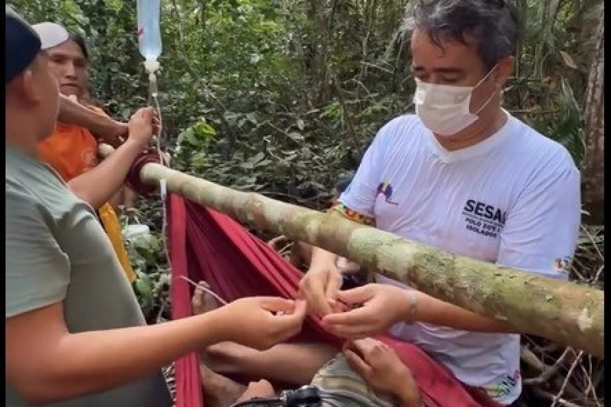 flecha durante caçada no interior do PA Um indígena do povo Zo’é foi resgatado a