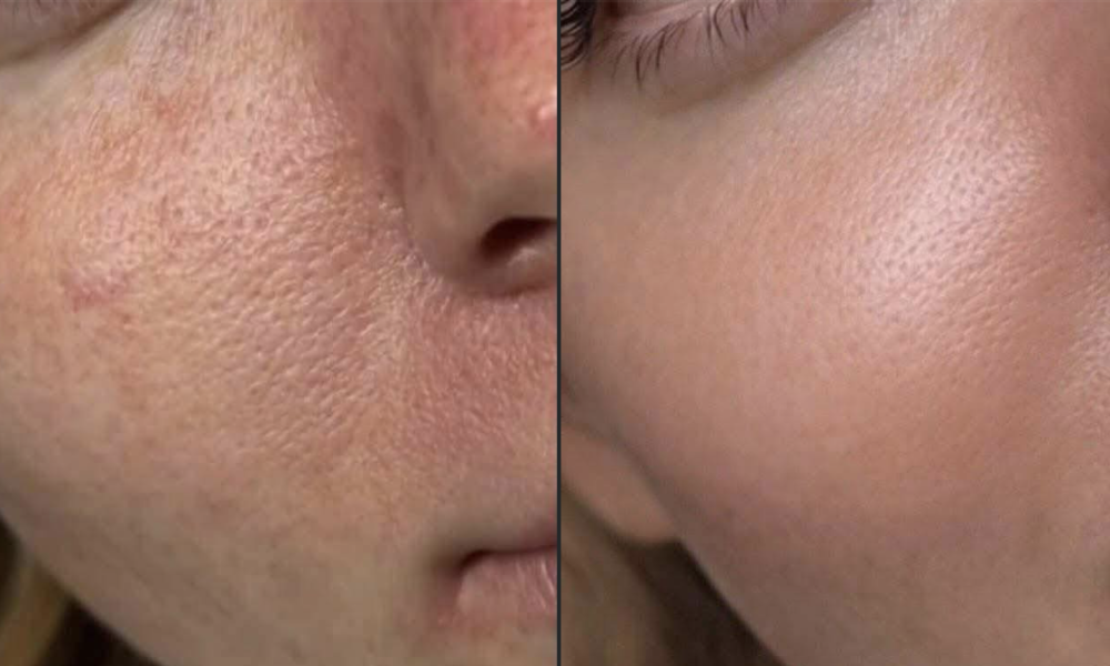 Imagem gerada com IA