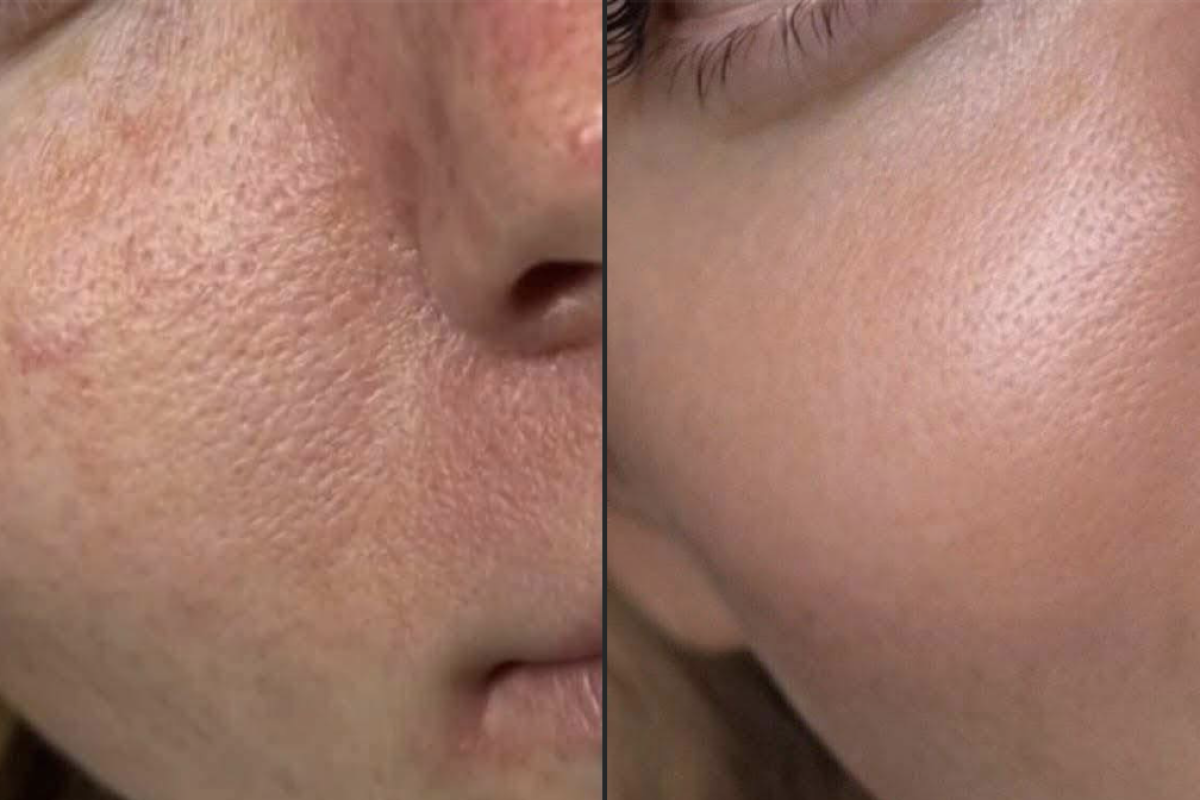 Imagem gerada com IA