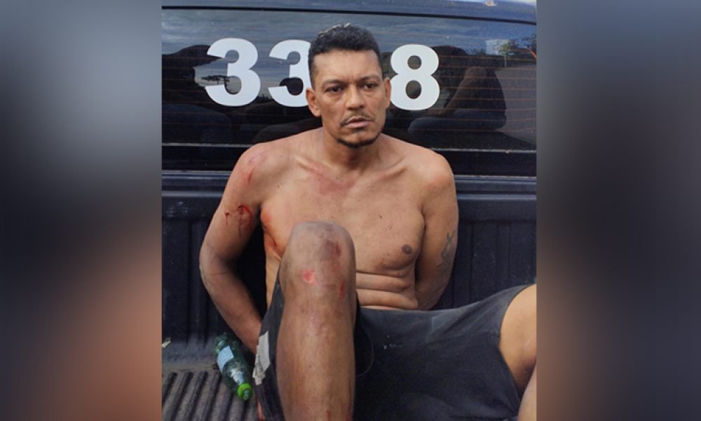 Homem sem camisa com ferimentos e algemado em parte traseira de veículo policial.